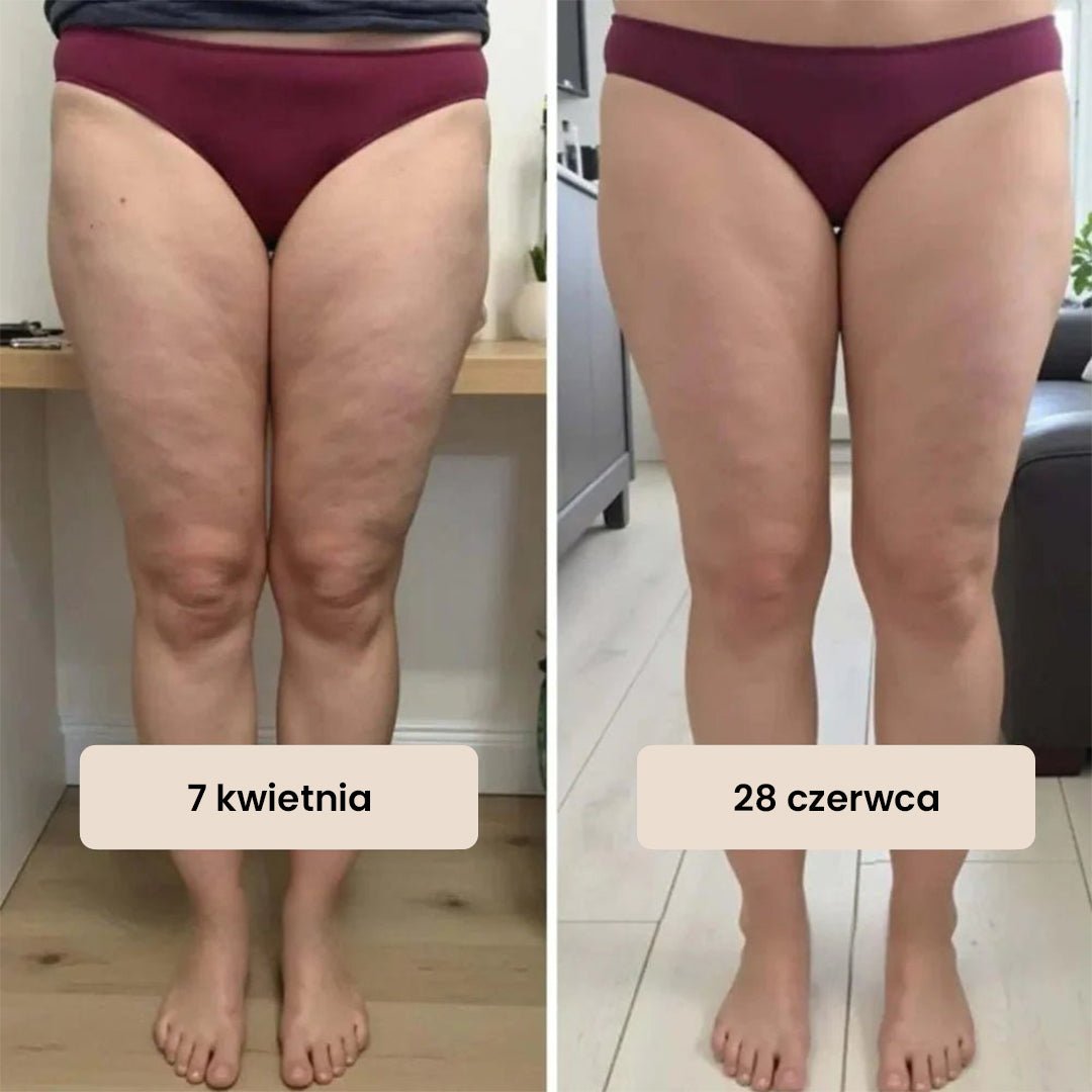 Legginsy antycellulitowe - Ironfit PL
